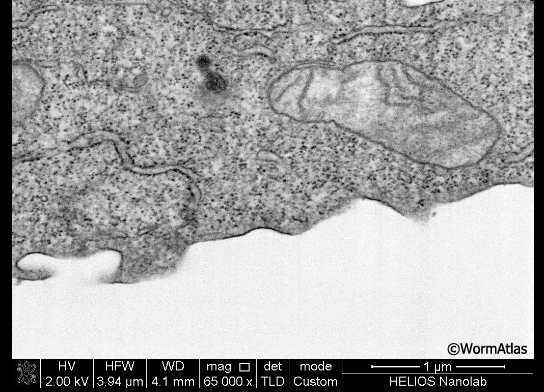 EMFIBSEMFIG 1: FIB/SEM imaging. 